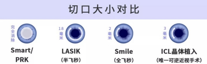 1680297713532761.jpg Tigerless虎虎保险_近视眼手术.jpg
